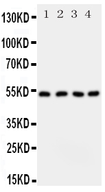 Anti-SPTLC1 antibody, PA1777, Western blotting All lanes: Anti SPTLC1 (PA1777) at 0.5ug/ml