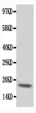 Anti-cardiac Troponin C antibody, PA1779, Western blotting All lanes: Anti cardiac Troponin C (PA1779) at 0.5ug/ml