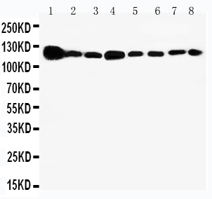 Anti-Vinculin antibody, PA1781, Western blotting Lane 1: Rat Heart Tissue Lysate Lane 2: Rat Brain Tissue Lysate Lane 3: Rat Liver Tissue Lysate Lane 4: U87 Cell Lysate Lane 5: SMMC Cell Lysate Lane 6: HEPA Cell Lysate Lane 7: HELA Cell Lysate