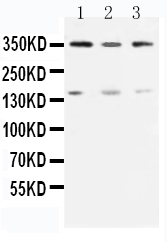 Anti-ATM antibody, PA1784, Western blotting Lane 1: Rat Testis Tissue Lysate Lane 2: U87 Cell Lysate Lane 3: MCF-7 Cell Lysate