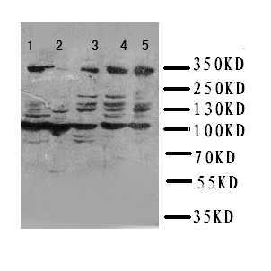 Anti-ATM antibody, PA1784, Western blotting Lane 1: HELA Cell Lysate Lane 2: SMMC Cell Lysate Lane 3: U87 Cell Lysate Lane 4: A549 Cell Lysate Lane 5: MCF-7 Cell Lysate