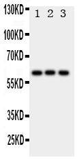 Anti-HEXA antibody, PA1787, Western blotting All lanes: Anti HEXA (PA1787) at 0.5ug/ml