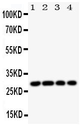 Anti-HLA DMB antibody, PA1788, Western blotting All lanes: Anti HLA DMB (PA1788) at 0.5ug/ml