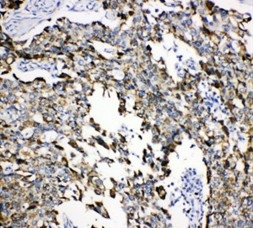 IHC analysis of Grp75 using anti-Grp75 antibody (PA1789).