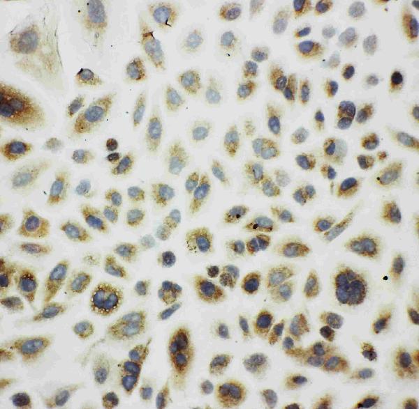 IHC analysis of Cpn10 using anti-Cpn10 antibody (PA1790). Cpn10 was detected in immunocytochemical section of A549 Cell. Enzyme antigen retrieval was performed using IHC enzyme antigen retrieval reagent (AR0022) for 15 mins. The cells were blocked with 10% goat serum. And then incubated with 1μg/ml rabbit anti-Cpn10 Antibody (PA1790) overnight at 4°C. Biotinylated goat anti-rabbit IgG was used as secondary antibody and incubated for 30 minutes at 37°C. The section was developed using Strepavidin-Biotin-Complex (SABC)(Catalog # SA1022) with DAB as the chromogen.