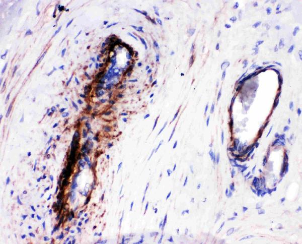 Anti-LASP1 antibody, PA1791-1, IHC(P) IHC(P): Human Placenta Tissue