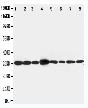 Anti-LASP1 antibody, PA1791, Western blotting Lane 1: Rat Liver Tissue Lysate Lane 2: Rat Spleen Tissue Lysate Lane 3: Rat Intestine Tissue Lysate Lane 4: JURKAT Cell Lysate Lane 5: MCF-7 Cell Lysate Lane 6: A431 Cell Lysate Lane 7: HELA Cell Lysate