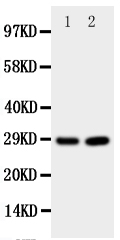 Anti-PRNP antibody, PA1795, Western blotting All lanes: Anti PRNP (PA1795) at 0.5ug/ml