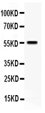 Anti-TFPI antibody, PA1798, Western blotting All lanes: Anti TFPI (PA1798) at 0.5ug/ml WB: SMMC Whole Cell Lysate at 40ug Predicted bind size: 26KD Observed bind size: 55KD