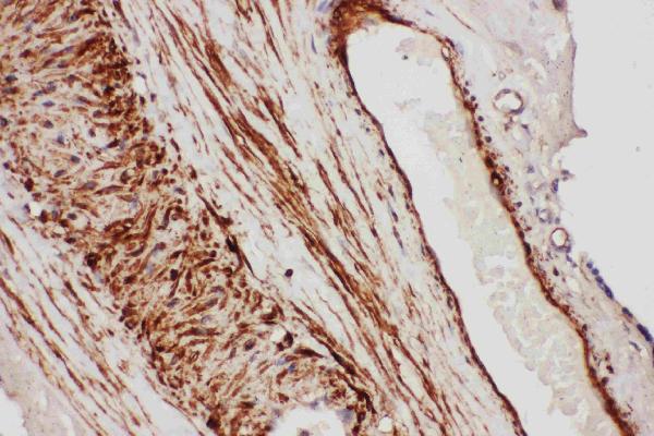 Anti-TFPI antibody, PA1798, IHC(P) IHC(P): Human Placenta Tissue