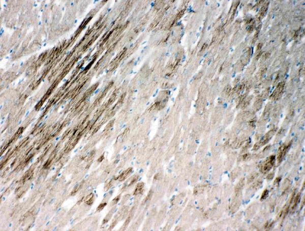 Anti-HSPB2 antibody, PA1802, IHC(F) IHC(F): Rat Cardiac Muscle Tissue