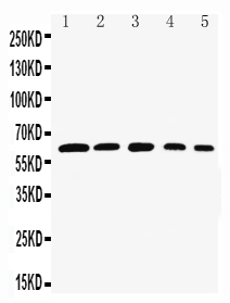 Anti-Rel B antibody, PA1803, Western blotting Lane 1: Rat Testis Tissue Lysate Lane 2: HELA Cell Lysate Lane 3: NIH3T3 Cell Lysate Lane 4: RAJI Cell Lysate Lane 5: HEPA Cell Lysate