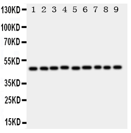 Anti-E2F2 antibody, PA1810, Western blotting All lanes: Anti E2F2 (PA1810) at 0.5ug/ml