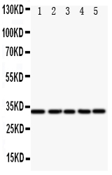 Anti-E2F6 antibody, PA1811, Western blotting All lanes: Anti E2F6 (PA1811) at 0.5ug/ml