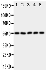 Anti-HYAL2 antibody, PA1817, Western blotting All lanes: Anti HYAL2 (PA1817) at 0.5ug/ml