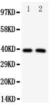 Anti-IRF2 antibody, PA1818, Western blotting All lanes: Anti IRF2 (PA1818) at 0.5ug/ml