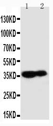 Anti-Kallikrein 9 antibody, PA1820, Western blotting Lane 1: MCF-7 Cell Lysate Lane 2: A431 Cell Lysate