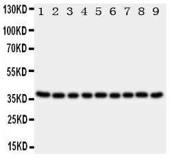 Anti-Kallikrein 10 antibody, PA1821, Western blotting All lanes: Anti Kallikrein 10 (PA1821) at 0.5ug/ml