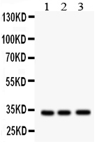 Anti-MPG antibody, PA1825, Western blotting All lanes: Anti MPG (PA1825) at 0.5ug/ml Lane 1: Rat Liver Tissue Lysate at 50ug Lane 2: HELA Whole Cell Lysate at 40ug Lane 3: JURKAT Whole Cell Lysate at 40ug Predicted bind size: 33KD Observed bind size: 33KD