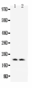 Anti-Myoglobin antibody, PA1826, Western blotting Lane 1: Human Placenta Tissue Lysate Lane 2: Human Placenta Tissue Lysate