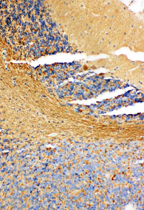 IHC analysis of NM23A using anti-NM23A antibody (PA1829). NM23A was detected in paraffin-embedded section of Rat Cerebellum tissues. Heat mediated antigen retrieval was performed in citrate buffer (pH6, epitope retrieval solution) for 20 mins. The tissue section was blocked with 10% goat serum. The tissue section was then incubated with 1μg/ml rabbit anti-NM23A Antibody (PA1829) overnight at 4°C. Biotinylated goat anti-rabbit IgG was used as secondary antibody and incubated for 30 minutes at 37°C. The tissue section was developed using Strepavidin-Biotin-Complex (SABC)(Catalog # SA1022) with DAB as the chromogen.