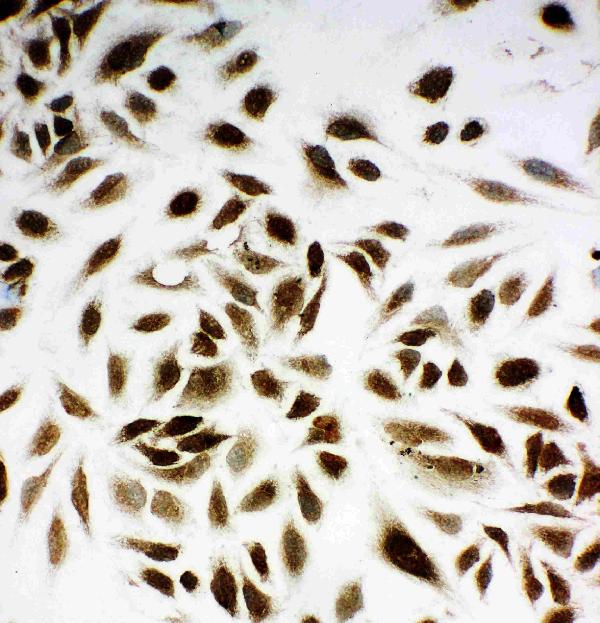 IHC analysis of NM23A using anti-NM23A antibody (PA1829). NM23A was detected in immunocytochemical section of HELA Cell. Enzyme antigen retrieval was performed using IHC enzyme antigen retrieval reagent (AR0022) for 15 mins. The cells were blocked with 10% goat serum. And then incubated with 1μg/ml rabbit anti-NM23A Antibody (PA1829) overnight at 4°C. Biotinylated goat anti-rabbit IgG was used as secondary antibody and incubated for 30 minutes at 37°C. The section was developed using Strepavidin-Biotin-Complex (SABC)(Catalog # SA1022) with DAB as the chromogen.