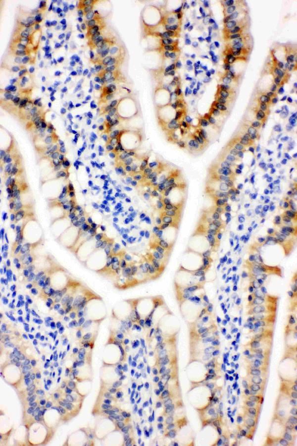 IHC analysis of PRDX3 using anti-PRDX3 antibody (PA1836).