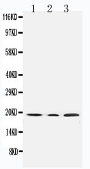 Anti-SDHC antibody, PA1839, Western blotting All lanes: Anti SDHC (PA1839) at 0.5ug/ml