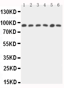 Anti-STAT5b antibody, PA1841, Western blotting Lane 1: Rat Intestine Tissue Lysate Lane 2: Rat Kidney Tissue Lysate Lane 3: HELA Cell Lysate Lane 4: A549 Cell Lysate Lane 5: MM231 Cell Lysate Lane 6: COLO320 Cell Lysate