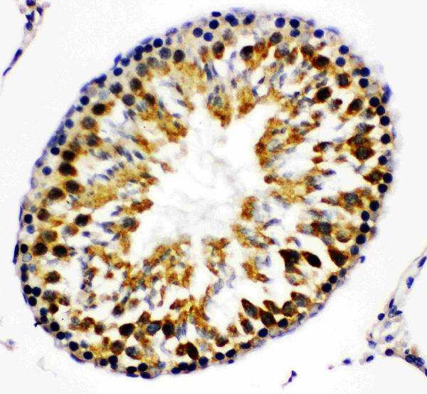 Anti-Beta Arrestin 2 antibody, PA1845, IHC(P) IHC(P): Rat Testis Tissue