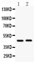 Anti-Beta Arrestin 2 antibody, PA1845, Western blotting All lanes: Anti ARRB2 (PA1845) at 0.5ug/ml Lane 1: HELA Whole Cell Lysate at 40ug Lane 2: Rat Skeletal Muscle Tissue Lysate at 50ug Predicted bind size: 46KD Observed bind size: 46KD