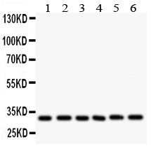 Anti-CASP3 antibody, PA1849, Western blotting All lanes: Anti CASP3 (PA1849) at 0.5ug/ml Lane 1: Rat Cardiac Muscle Tissue Lysate at 50ug Lane 2: Rat Liver Tissue Lysate at 50ug Lane 3: Rat Thymus Tissue Lysate at 50ug Lane 4: MCF-7 Whole Cell Lysate at 40ug Lane 5: SMMC Whole Cell Lysate at 40ug Lane 6: HT1080 Whole Cell Lysate at 40ug Predicted bind size: 31KD Observed bind size: 31KD