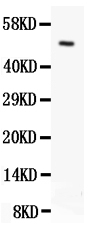 Anti-Orai1 antibody, PA1857, Western blotting All lanes: Anti Orai1 (PA1857) at 0.5ug/ml WB: SKOV Whole Cell Lysate at 40ug Predicted bind size: 33KD Observed bind size: 50KD