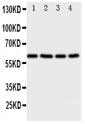 Anti-RIP2 antibody, PA1861, Western blotting All lanes: Anti RIP2 (PA1861) at 0.5ug/ml