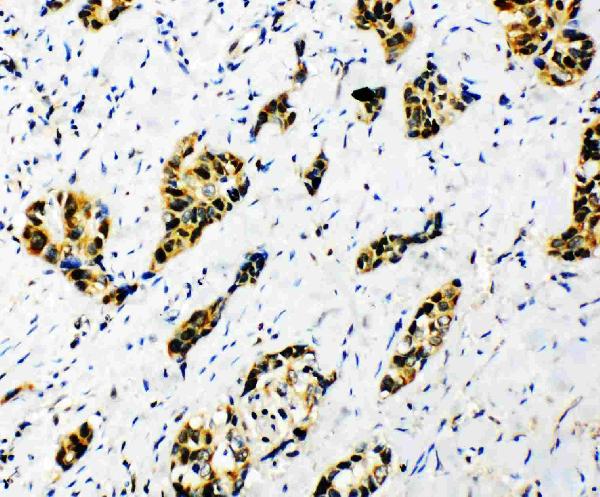 IHC analysis of splicing factor 1 using anti-splicing factor 1 antibody (PA1864).