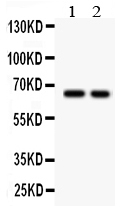 Anti-TGF beta Receptor II antibody, PA1866, Western blotting All lanes: Anti TGF beta Receptor II (PA1866) at 0.5ug/ml Lane 1: HEPG2 Whole Cell Lysate at 40ug