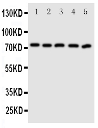 Western blot analysis of ABCG5 using anti-ABCG5 antibody (PA1871). Electrophoresis was performed on a 5-20% SDS-PAGE gel at 70V (Stacking gel) / 90V (Resolving gel) for 2-3 hours. The sample well of each lane was loaded with 50ug of sample under reducing conditions. Lane 1: MCF-7 Whole Cell Lysate Lane 2: A549 Whole Cell Lysate Lane 3: HT1080 Whole Cell Lysate Lane 4: U87 Whole Cell Lysate Lane 5: SKOV Whole Cell Lysate After Electrophoresis, proteins were transferred to a Nitrocellulose membrane at 150mA for 50-90 minutes. Blocked the membrane with 5% Non-fat Milk/ TBS for 1.5 hour at RT. The membrane was incubated with rabbit anti-ABCG5 antigen affinity purified polyclonal antibody (Catalog # PA1871) at 0.5 μg/mL overnight at 4°C, then washed with TBS-0.1%Tween 3 times with 5 minutes each and probed with a goat anti-rabbit IgG-HRP secondary antibody at a dilution of 1:10000 for 1.5 hour at RT. The signal is developed using an Enhanced Chemiluminescent detection (ECL) kit (Catalog # EK1002) with Tanon 5200 system. A specific band was detected for ABCG5 at approximately 73KD. The expected band size for ABCG5 is at 73KD.