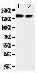 Anti-ErbB 4 antibody, PA1881, Western blotting Lane 1: A549 Cell Lysate Lane 2: HELA Cell Lysate