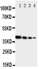 Anti-ErbB 4 antibody, PA1881, Western blotting Recombinant Protein Detection Source: E.coli derived -recombinant human ERRB4, 40.6KD