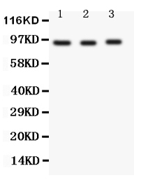 Anti-FER antibody, PA1882, Western blotting All lanes: Anti FER (PA1882) at 0.5ug/ml Lane 1: HELA Whole Cell Lysate at 40ug Lane 2: Rat Testis Tissue Lysate at 50ug Lane 3: Rat Ovary Tissue Lysate at 50ug Predicted bind size: 95KD Observed bind size: 95KD