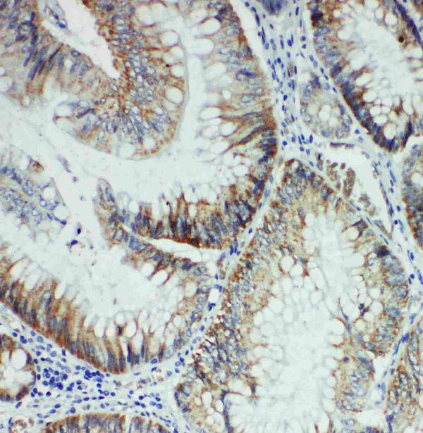 Anti-FER antibody, PA1882, IHC(P) IHC(P): Rat Intestine Tissue