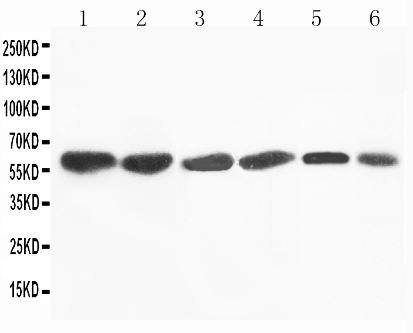 Anti-Flavin containing monooxygenase 4 antibody, PA1883, Western blotting Lane 1: Rat Liver Tissue Lysate Lane 2: Mouse Liver Tissue Lysate Lane 3: SMMC Cell Lysate Lane 4: HEPA Cell Lysate Lane 5: A431 Cell Lysate Lane 6: MCF-7 Cell Lysate