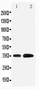 Anti-KLF3 antibody, PA1888, Western blotting Lane 1: Rat Testis Tissue Lysate Lane 2: HELA Cell Lysate