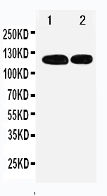 Anti-p107 antibody, PA1894, Western blotting Lane 1: 239T Cell Lysate Lane 2: JURKAT Cell Lysate