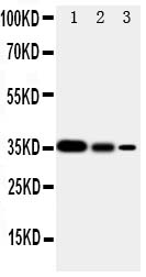 Anti-SHC antibody, PA1897, Western blotting Recombinant Protein Detection Source: E.coli derived -recombinant human SHC1, 35.0KD(162aa tag+D424-P578) Lane 1: Recombinant Human SHC1 Proteins 10ng Lane 2: Recombinant Human SHC1 Proteins 5ng Lane 3: Recombinant Human SHC1 Proteins 2.5ng