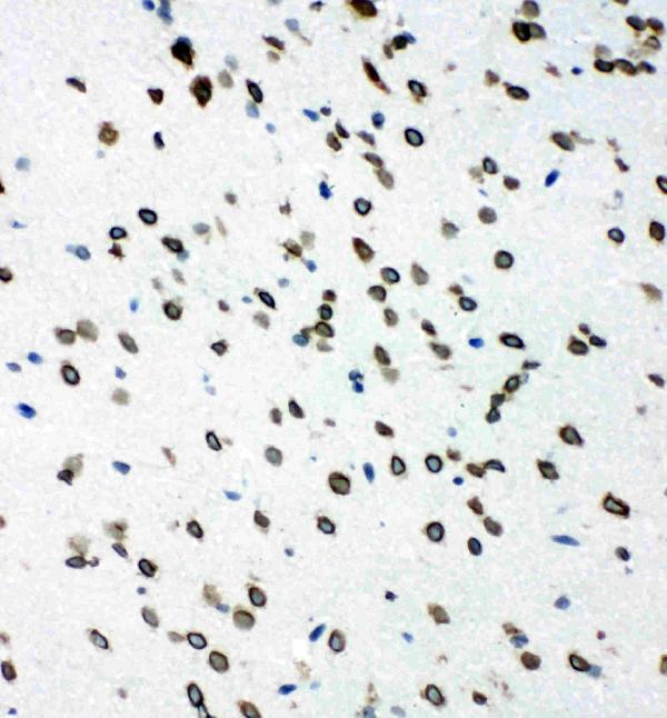 Anti-SHC antibody, PA1897, IHC(F) IHC(F): Rat Brain Tissue