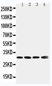 Anti-SOD3 antibody, PA1899, Western blotting Lane 1: Human Placenta Tissue Lysate Lane 2: A549 Cell Lysate Lane 3: MM231 Cell Lysate Lane 4: MCF-7 Cell Lysate