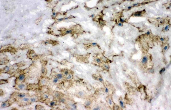 Anti-SOD3 antibody, PA1899, IHC(F) IHC(F): Human Placenta Tissue