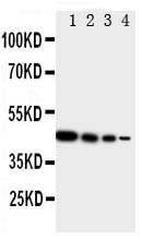 Anti-TRIF antibody, PA1902, Western blotting Recombinant Protein Detection Source: E.coli derived -recombinant Human TICAM1, 44.7KD(162aa tag+ Q468-E712) Lane 1: Recombinant Human TICAM1 Protein 10ng Lane 2: Recombinant Human TICAM1 Protein 5ng Lane 3: Recombinant Human TICAM1 Protein 2.5ng Lane 4: Recombinant Human TICAM1 Protein 1.25ng