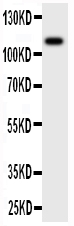 Anti-MCSF Receptor antibody, PA1905, Western blotting WB: Rat Intestine Tissue Lysate